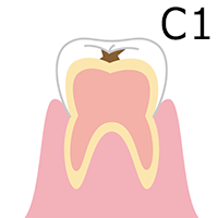 C1