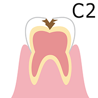 C2