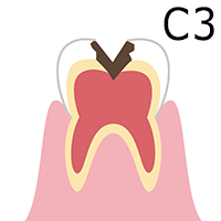 C3