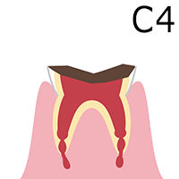 C4