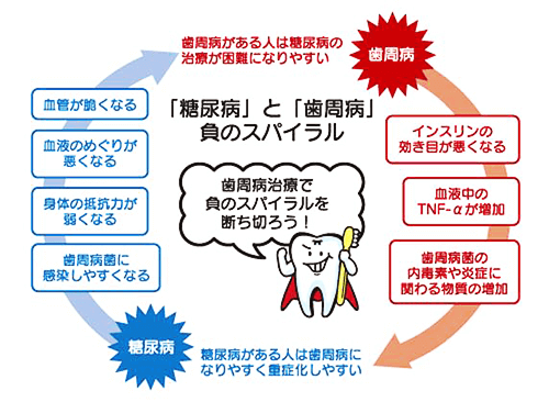 糖尿病と歯周病の負のスパイラル