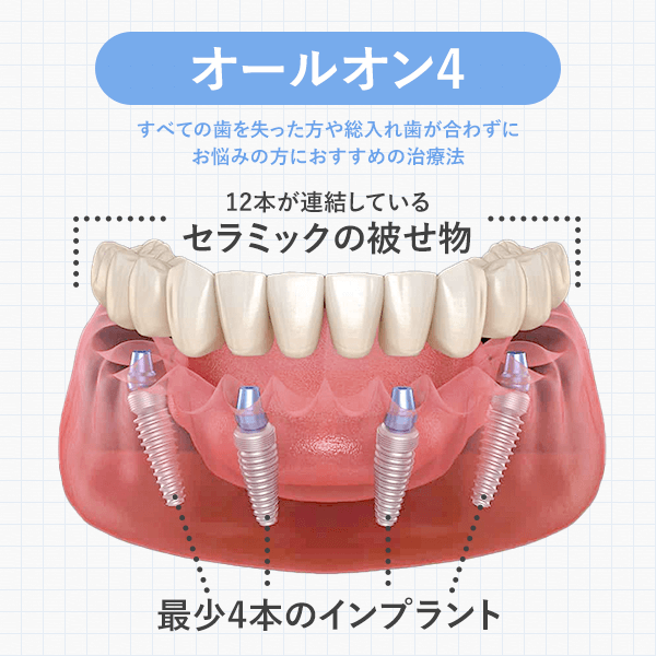 オールオン4