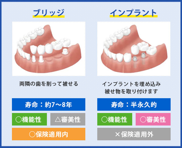 ブリッジとインプラント比較表