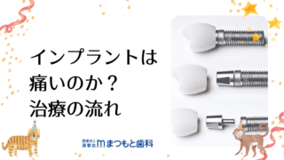 【新品】インプラント周囲炎 予防マニュアル インプラント周囲炎の予防と対策｜まつもと歯科吹田本院 よく