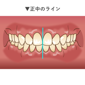 正中のライン