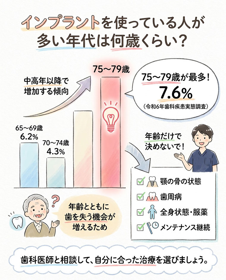 インプラントを使っている人が多い年代は何歳くらい？の図解