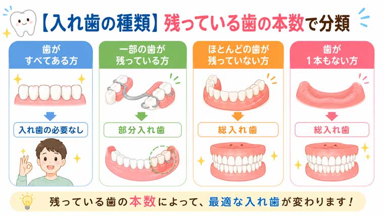 【入れ歯の種類】残っている歯の本数で分類の図解