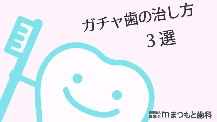 ガチャ歯の治し方3選