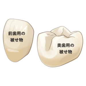 前歯用と奥歯用の被せ物