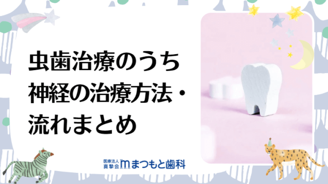 虫歯治療のうち神経の治療方法・流れまとめ