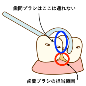 フロスの使い方