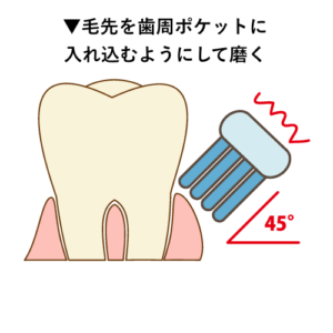 歯ブラシの当て方