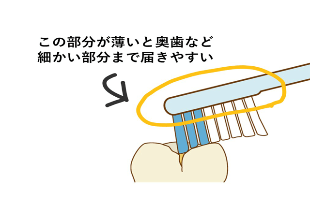歯周病予防・ケア・治療中におすすめの歯ブラシ3選｜歯科衛生士がお口の悩みに答えます