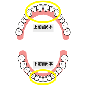 上下の前歯6本ずつ
