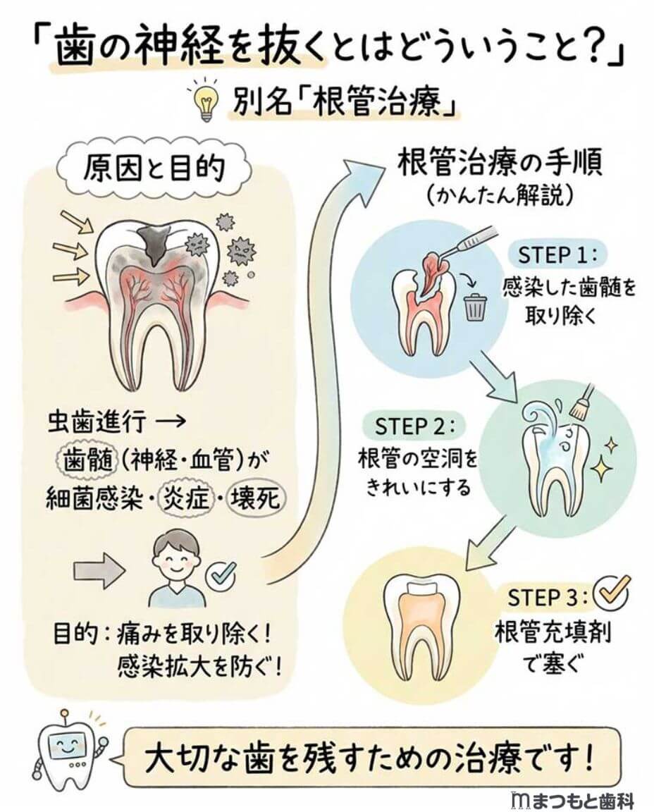 歯の神経を抜くとはどういうこと？