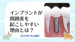 【新品】インプラント周囲炎 予防マニュアル Amazon.co.jp: エキスパートが初めて明かす技のバイブル