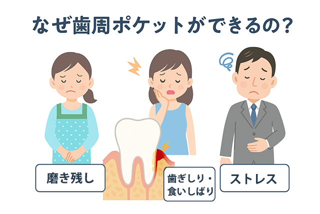 ポケットが出来るのか