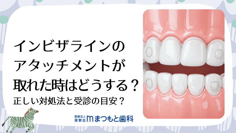 インビザラインのアタッチメントが取れた時はどうする？正しい対処法と受診の目安