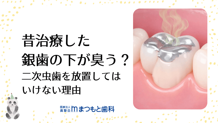 昔治療した銀歯の下が臭う？二次虫歯を放置してはいけない理由