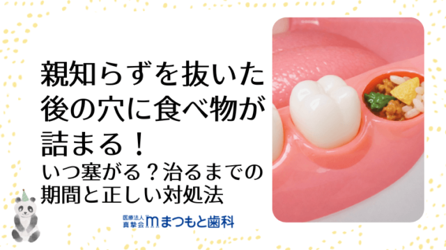 親知らずを抜いた後の穴に食べ物が詰まる！いつ塞がる？治るまでの期間と正しい対処法