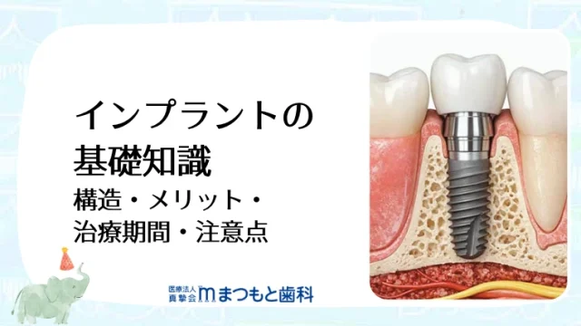 インプラントの基礎知識｜構造・メリット・治療期間・注意点