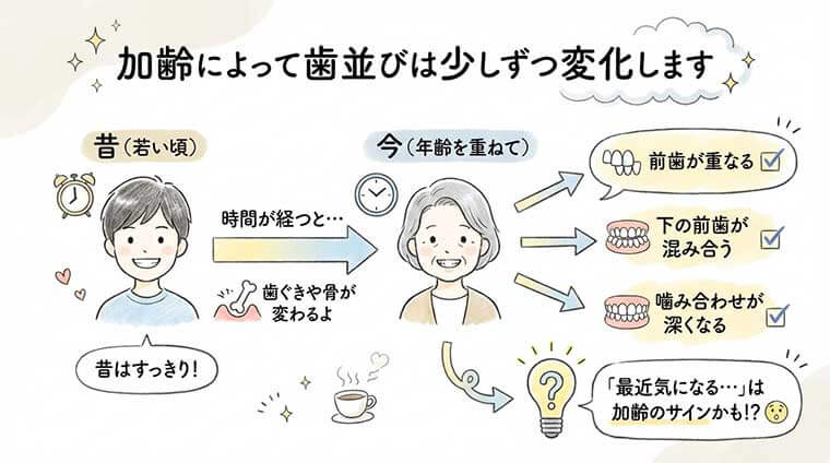 加齢によって歯並びは少しずつ変化しますの図解