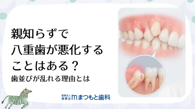 親知らずで八重歯が悪化することはある？歯並びが乱れる理由とは