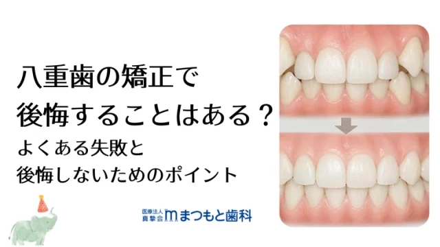 八重歯の矯正で後悔することはある？よくある失敗と後悔しないためのポイント