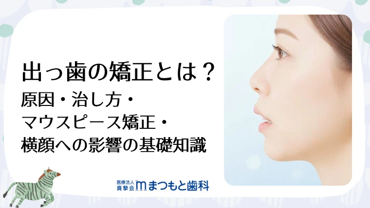 出っ歯の矯正とは？原因・治し方・マウスピース矯正・横顔への影響の基礎知識