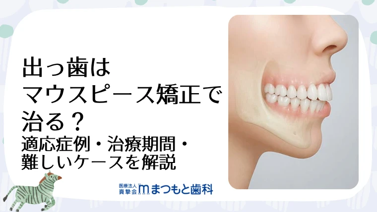 出っ歯はマウスピース矯正で治る？適応症例・治療期間・難しいケースを解説