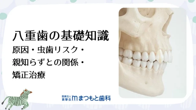 八重歯の基礎知識｜原因・虫歯リスク・親知らずとの関係・矯正治療