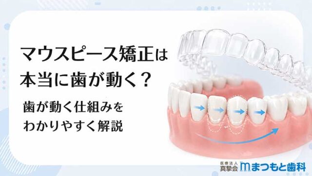 マウスピース矯正は本当に歯が動く？歯が動く仕組みをわかりやすく解説