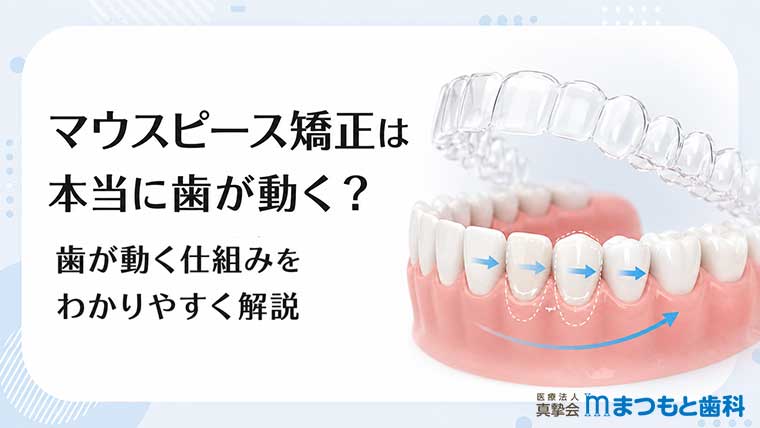 マウスピース矯正は本当に歯が動く？歯が動く仕組みをわかりやすく解説