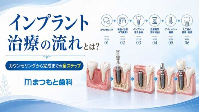 インプラント治療の流れとは？カウンセリングから完成までの全ステップ
