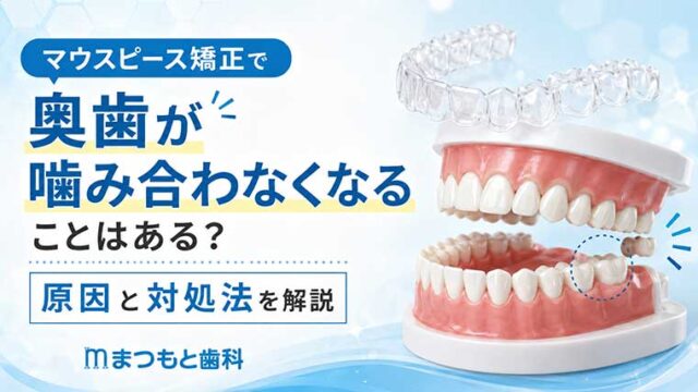 マウスピース矯正で奥歯が噛み合わなくなることはある？原因と対処法を解説