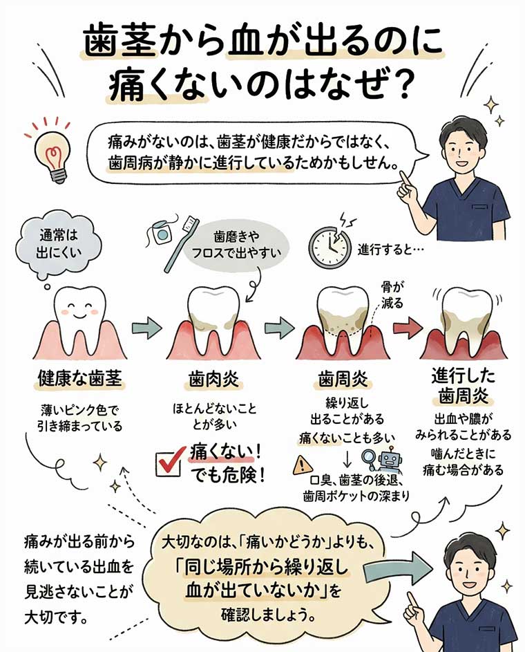 歯茎から血が出るのに痛くないのはなぜ？の図解