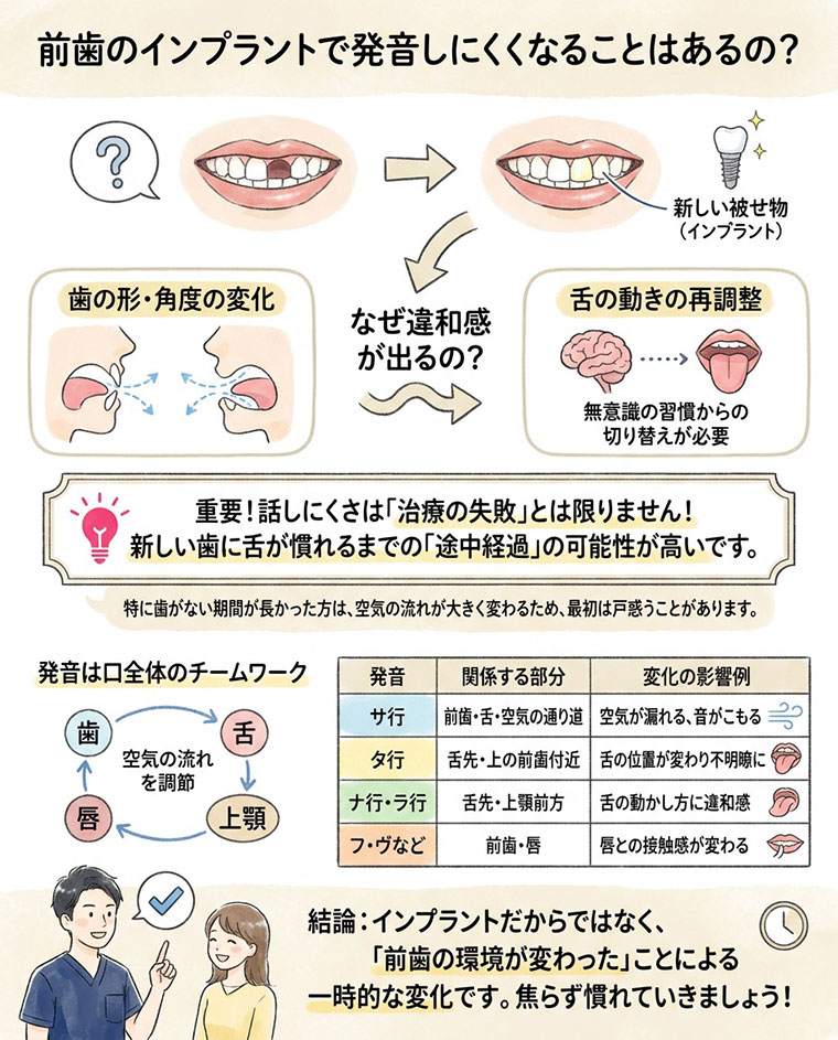 前歯のインプラントで発音しにくくなることはあるの？の図解