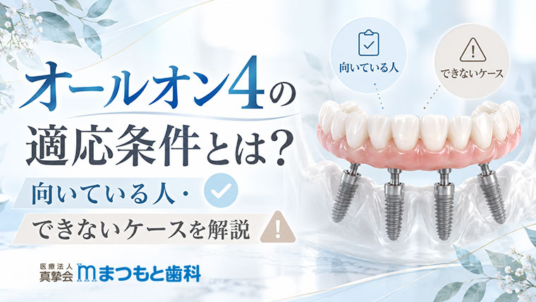 オールオン4の適応条件とは？向いている人・できないケースを解説