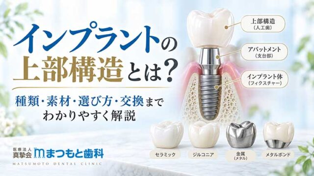 インプラントの上部構造とは？種類・素材・選び方・交換までわかりやすく解説