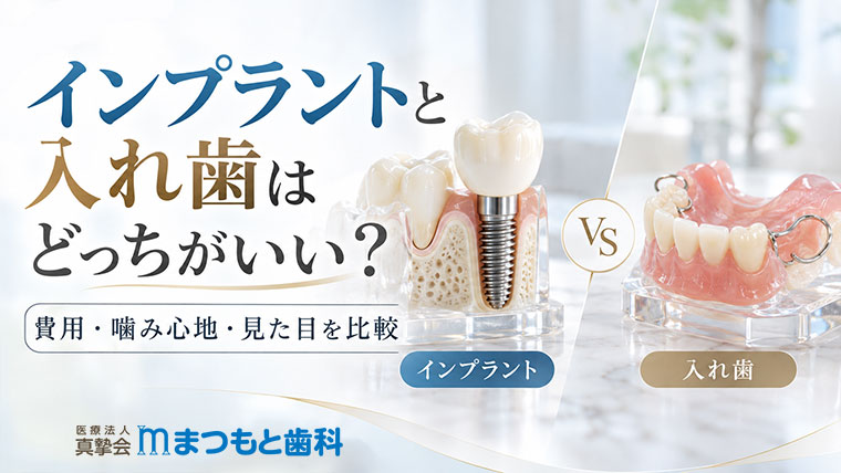インプラントと入れ歯はどっちがいい？費用・噛み心地・見た目を比較